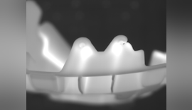 Thermographische Qualitätsprüfung von Spritzgussteilen - Thermografie